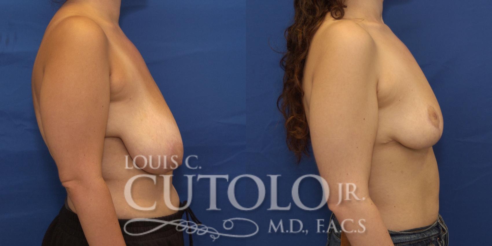 Right lateral pre op 